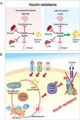 Insulin Resistance in HIV-Patients: Causes and Consequences